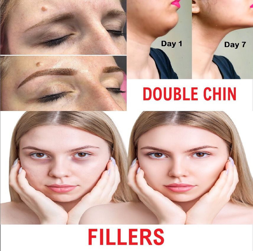 Skin Treatment